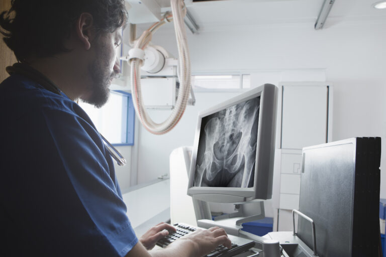 PSMA Imaging & Radioligand Therapy in Prostate Cancer: A New Era in Detection and Treatment